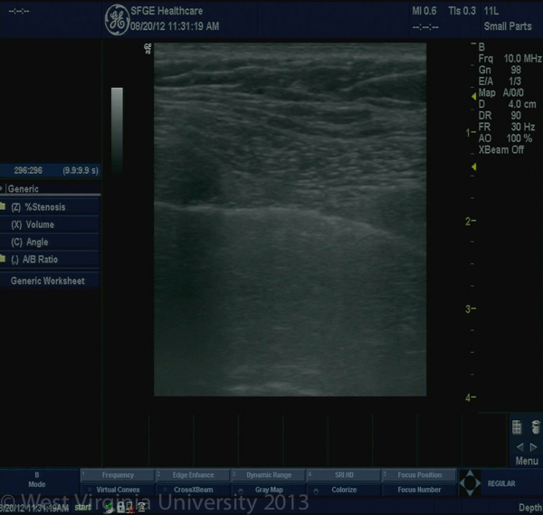 Ultrasound Screen